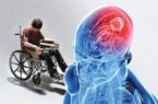 ای ال‌اس؛ وقتی نفس کشیدن هم به حمایت نیاز دارد